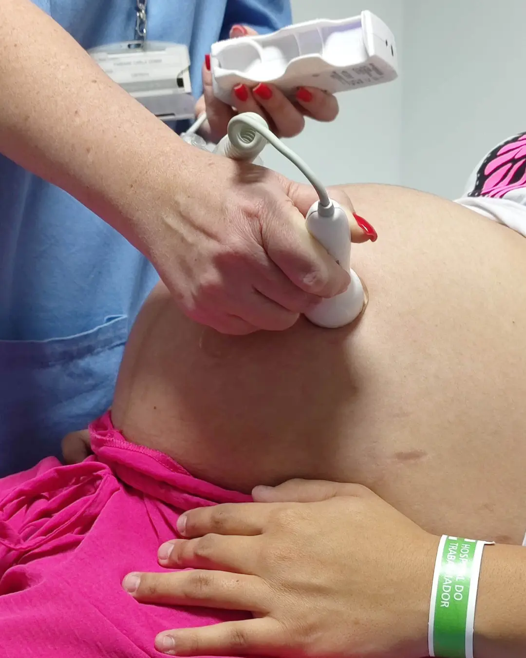 Gravidez na adolescência diminui 38% no Paraná em cinco anos, aponta Sesa